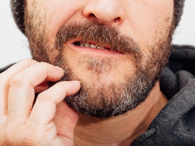 Comment lutter contre les pellicules dans sa barbe?